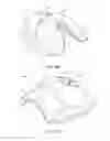 Fig. 23 - Low-profile single and dual vascular access device