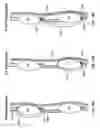 Fig. 35 - Methods for using an electrical dermal patch in a manner that reduces adverse patient reactions