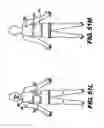 Fig. 49 - Obstructive sleep apnea treatment devices, systems and methods