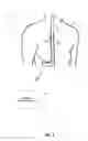 Fig. 02 - Dorsal spinal column characterization with evoked potentials