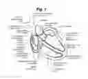 Fig. 02 - Permanent his-bundle pacing device and method