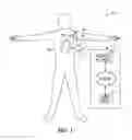 Fig. 02 - External audit of implantable medical device