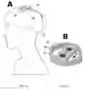 Fig. 09 - Time-varying magnetic field therapy using multistable latching mechanisms