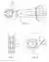 Fig. 03 - Vehicle driveline servicing apparatus and method