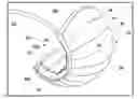 Fig. 01 - Pneumatic exomuscle system and method