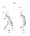 Fig. 02 - Joint actuator, and joint structure of leg-supporting robot comprising same