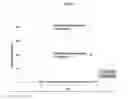 Fig. 02 - Carbidopa and L-dopa prodrugs and methods of use