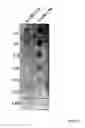 Fig. 04 - Method for increasing ETEC CS6 antigen presentation on cell surface and products obtainable thereof