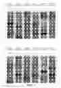 Fig. 02 - CDCA1-derived peptide and vaccine containing same
