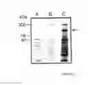 Fig. 02 - INTEGRIN HETERODIMER AND A SUBUNIT THEREOF