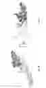 Fig. 04 - Antibody-mediated neutralization of Chikungunya virus