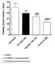 Fig. 01 - Multivalent Antibody Complexes Targeting IGF-1R Show Potent Toxicity Against Solid Tumors