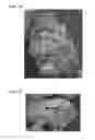 Fig. 06 - Super absorbent polymer