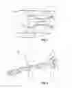 Fig. 02 - Assembly for passing an electrical harness into a turbine engine