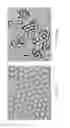 Fig. 09 - Systems including janus droplets capable of binding an analyte and changing orientation to provide a detectable change