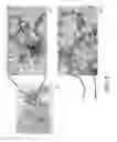 Fig. 02 - Immunohistochemical assay for detecting expression of programmed death ligand 1 (PD-L1) in tumor tissue