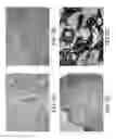 Fig. 04 - Immunohistochemical assay for detecting expression of programmed death ligand 1 (PD-L1) in tumor tissue