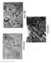 Fig. 06 - Immunohistochemical assay for detecting expression of programmed death ligand 1 (PD-L1) in tumor tissue