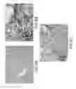 Fig. 07 - Immunohistochemical assay for detecting expression of programmed death ligand 1 (PD-L1) in tumor tissue
