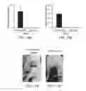 Fig. 08 - CANCER MARKER AND THE USE THEREOF