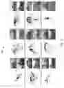Fig. 03 - Methods, systems, and computer readable media for image overlap detection