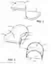 Fig. 02 - Mechanism for foundational breast support
