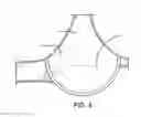 Fig. 03 - Mechanism for foundational breast support