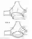 Fig. 04 - Mechanism for foundational breast support
