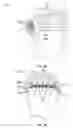 Fig. 08 - Surgical helmet