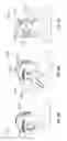 Fig. 35 - Surgical helmet