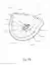 Fig. 19 - BODY PIERCING DEVICE AND SYSTEM