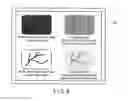 Fig. 09 - Special light endoscope