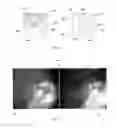 Fig. 04 - Eye imaging apparatus with sequential illumination and a syntactic image analyzing method