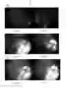 Fig. 05 - Eye imaging apparatus with sequential illumination and a syntactic image analyzing method