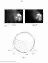 Fig. 06 - Eye imaging apparatus with sequential illumination and a syntactic image analyzing method