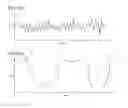 Fig. 08 - Pulse wave detection device and pulse wave detection program