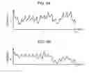 Fig. 08 - PULSE WAVE MEASURING APPARATUS, METHOD FOR MEASURING PULSE WAVES, AND RECORDING MEDIUM