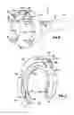 Fig. 08 - Apparatus and method for tissue closure