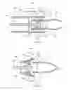 Fig. 02 - Sacrificial coupler for reloadable hemostasis clipping device
