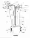 Fig. 03 - Patient-specific surgical guide