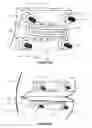 Fig. 06 - Patient-specific surgical guide