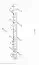 Fig. 153 - ASPIRATION AND MECHANICAL THROMBECTOMY METHODS