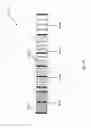 Fig. 154 - ASPIRATION AND MECHANICAL THROMBECTOMY METHODS