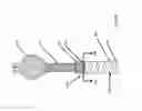 Fig. 159 - ASPIRATION AND MECHANICAL THROMBECTOMY METHODS