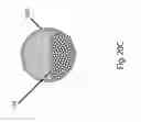 Fig. 161 - ASPIRATION AND MECHANICAL THROMBECTOMY METHODS