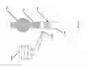 Fig. 162 - ASPIRATION AND MECHANICAL THROMBECTOMY METHODS