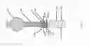 Fig. 170 - ASPIRATION AND MECHANICAL THROMBECTOMY METHODS