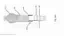 Fig. 173 - ASPIRATION AND MECHANICAL THROMBECTOMY METHODS