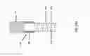 Fig. 174 - ASPIRATION AND MECHANICAL THROMBECTOMY METHODS