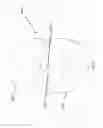 Fig. 18 - ASPIRATION AND MECHANICAL THROMBECTOMY METHODS